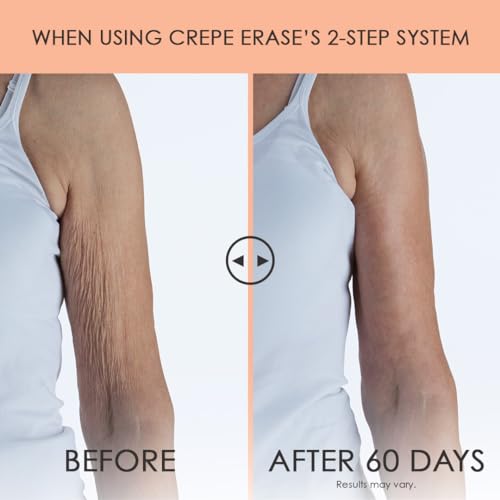 Crepe Erase Advanced Body Repair Treatment 10oz